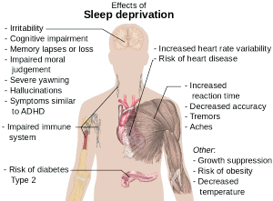 Schema che mostra gli effetti negativi della privazione del sonno sul corpo umano