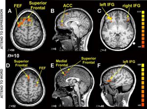 fmri stroop