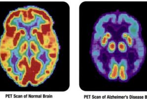 pet alzheimer