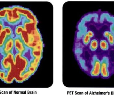 pet alzheimer