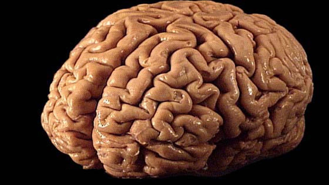 cervello umano