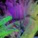 immagine di neuroimaging