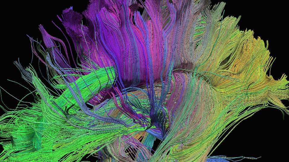 immagine di neuroimaging