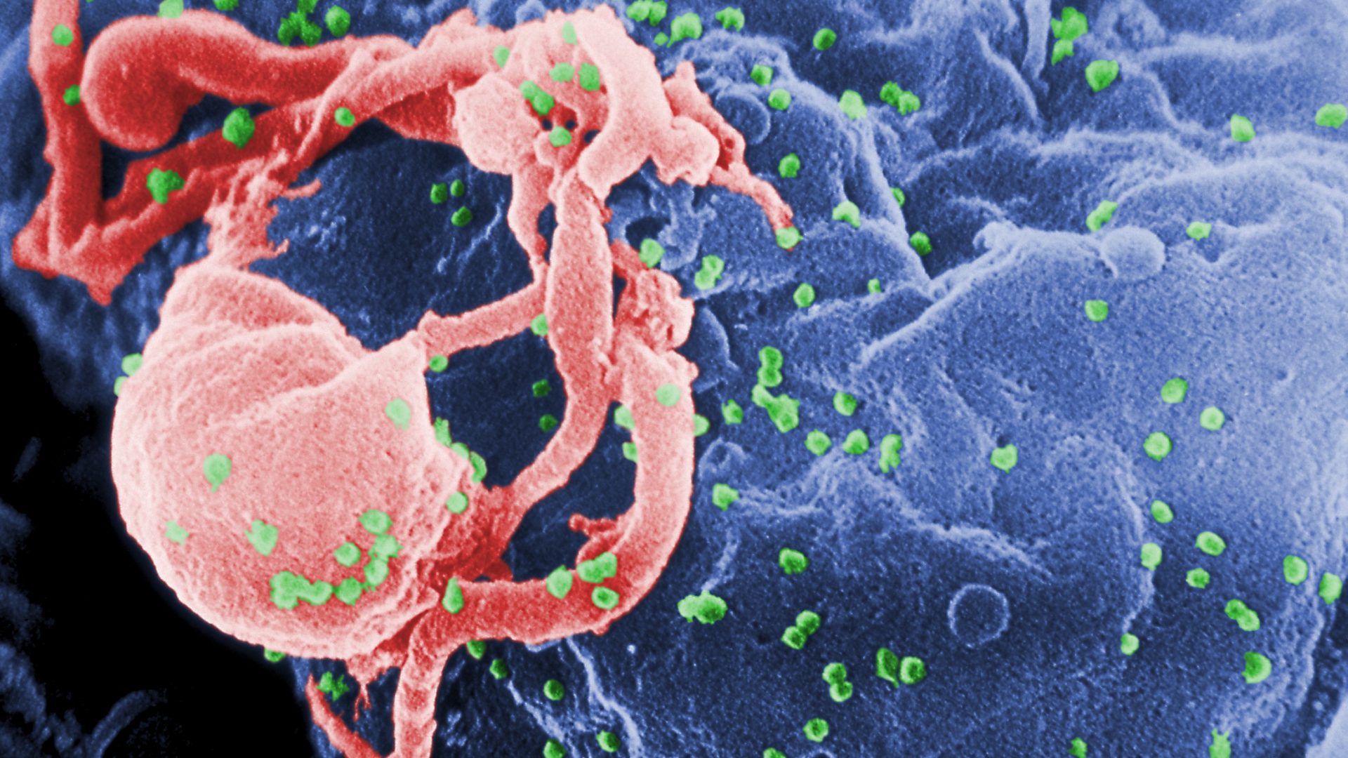 virus HIV