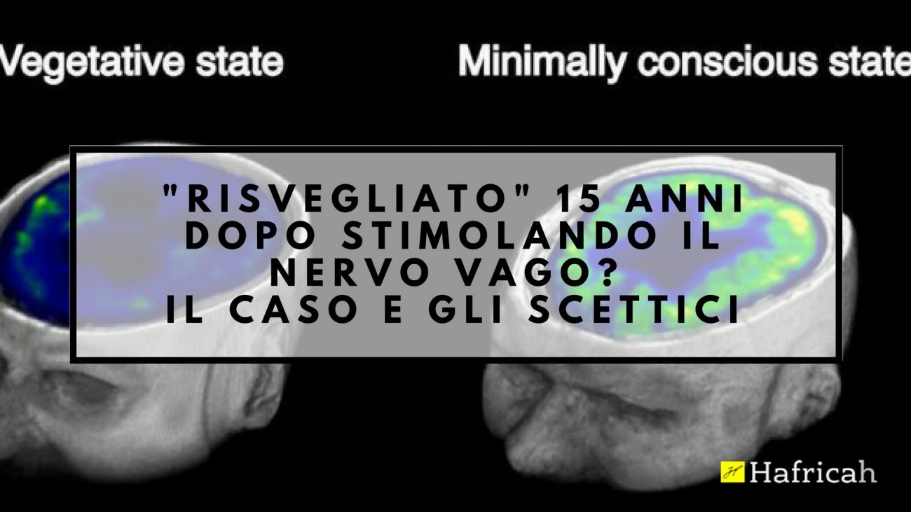 risveglio da stato vegetativo