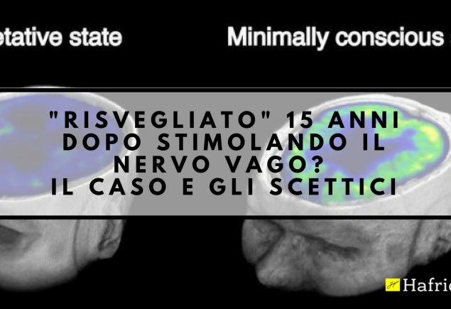 risveglio da stato vegetativo